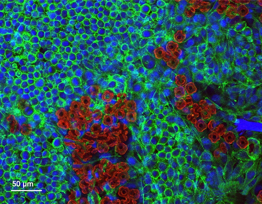 Konfokale Mikroaufnahme von im Strömungskanal 3D-gedruckten Partikeln (rot) mit Hohlräumen, woraus Zellkultur-Gerüststrukturen entstehen. Erste Anzeichen für die Selbstorganisation der Partikel sind sichtbar, obwohl dieser Prozess nach wie vor schwer zu steuern ist. Es gibt Anzeichen für Zellen (blau), die in die porösen Partikel eindringen, und Aktinfilamente (grün), die die Zellen durchdringen. 