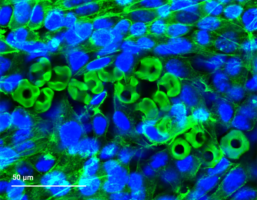 A confocal visualization of the particles (green). Particles tend to self-assemble, although not yet providing optimal results. The figure reveals interactions of the cells (blue) and particles