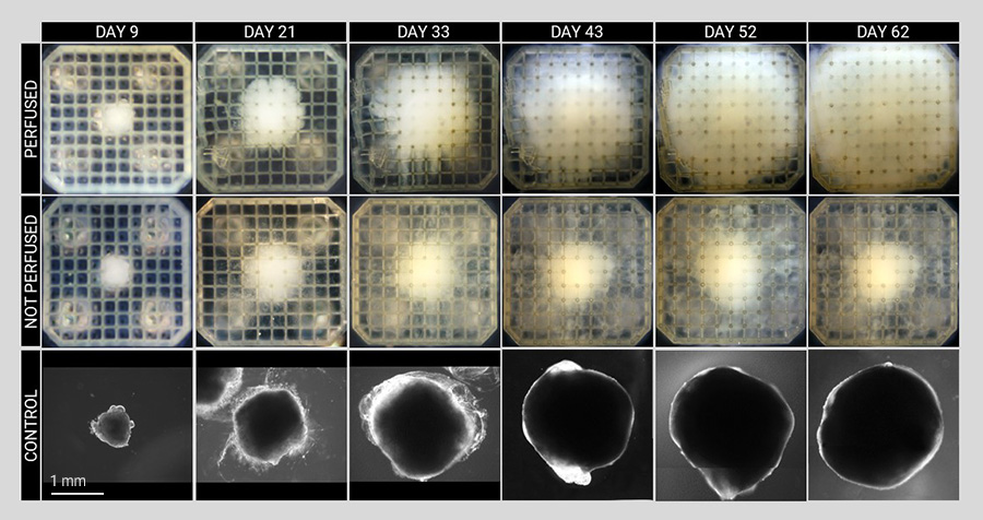 Bright field images of neural spheroids over the two-month culture period.  The organoid in the perfused grid showed progressive growth, while in the non-perfused grid a malformed fibrous-like tissue was produced