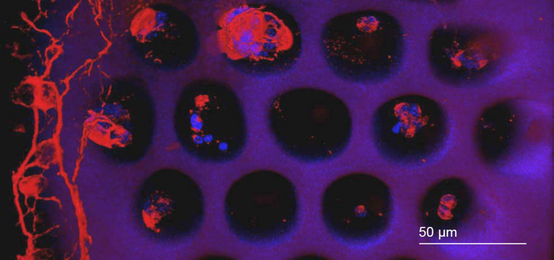 Primäre postnatale Netzhautzellen von Ratten, die mit Nanoscribes additiver Herstellungstechnologie hergestellt wurden. Bild: University of Iowa